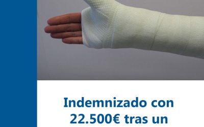 Recibe una indemnización de 22.500€ a un carpintero jubilado que perdió dos dedos en un accidente laboral